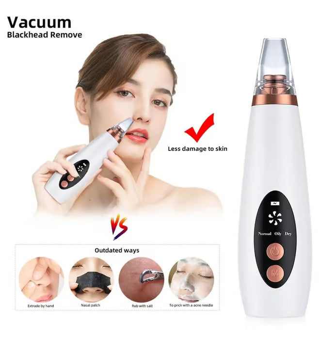 PoreGlow Pro™ – Deep Pore Vacuum Blackhead Remover