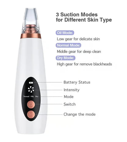 PoreGlow Pro™ – Deep Pore Vacuum Blackhead Remover