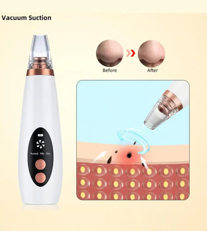PoreGlow Pro™ – Deep Pore Vacuum Blackhead Remover