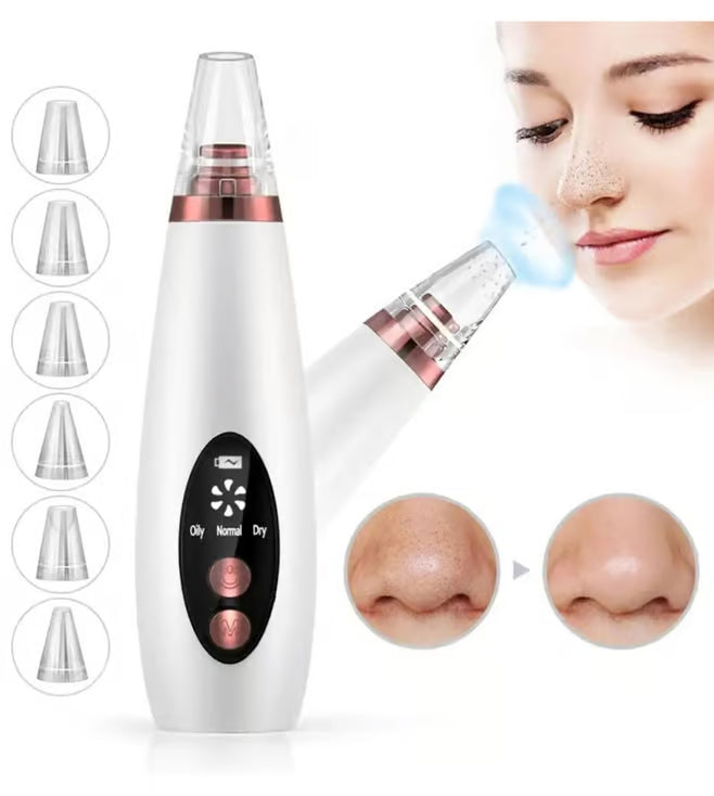 PoreGlow Pro™ – Deep Pore Vacuum Blackhead Remover